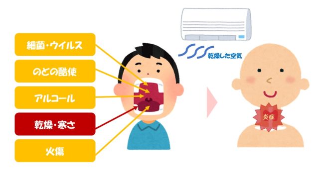 エアコンでのどが痛くなる原因